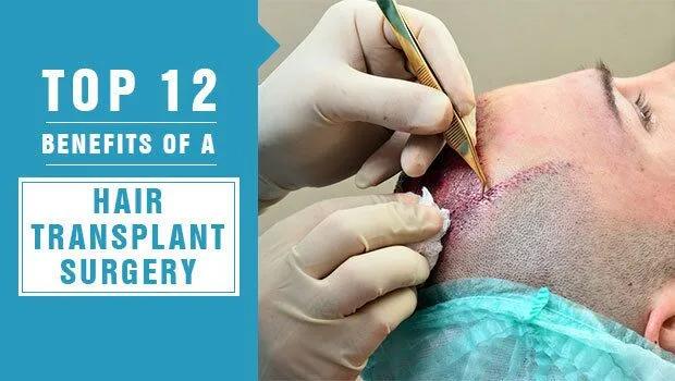 What Makes Turkey a Medical Tourism Hub for Hair Transplant
